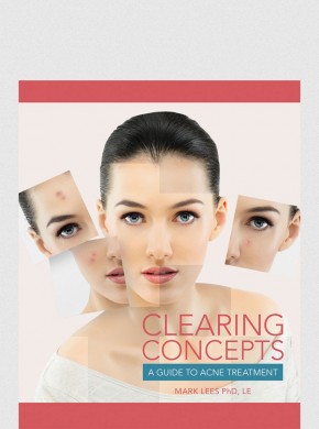 Clearing Concepts:A Guide to Acne Treatment 1